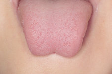 舌の表面